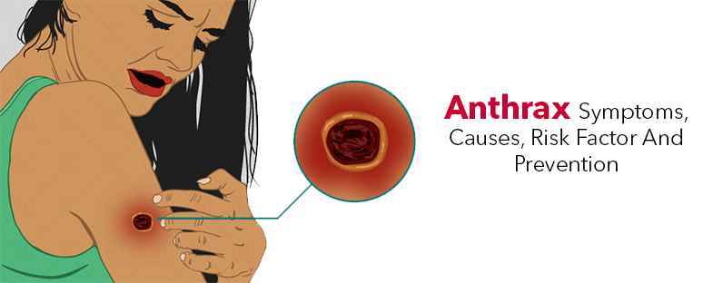 Anthrax Disease